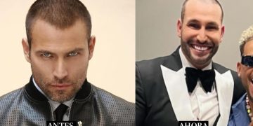 Desata polémica Rafael Amaya por cambio en su rostro