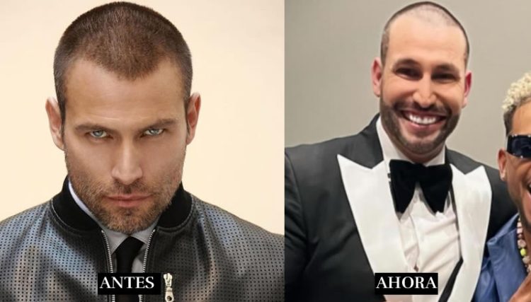 Desata polémica Rafael Amaya por cambio en su rostro