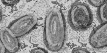 Reportan primer caso de viruela del mono en Nuevo León