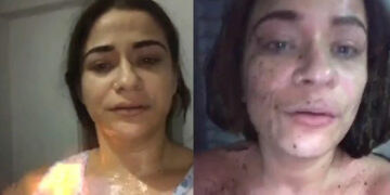 Mujer se prende fuego en nombre del amor romántico