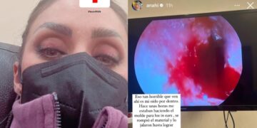 La cantante de RBD, Anahí, sufre perforación de tímpano a meses de gira reencuentro