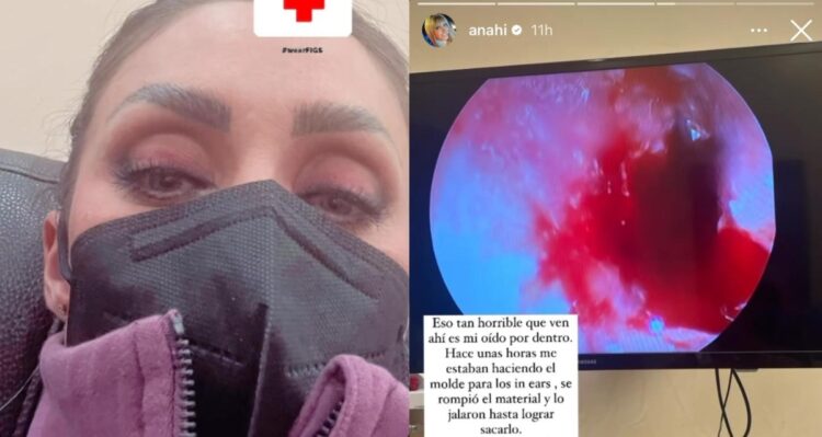 La cantante de RBD, Anahí, sufre perforación de tímpano a meses de gira reencuentro