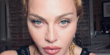 Madonna Hospitalizada por Grave Infección Bacteriana: Posponen el Inicio de su Gira Mundial