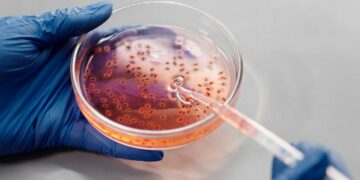 Aumentan a tres las muertes por meningitis en EEUU relacionadas con brote en Tamaulipas