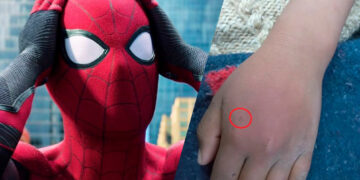 Niño en Bolivia es hospitalizado tras dejarse picar por araña intentando ser Spider-Man»