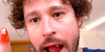 Luisito Comunica no se quedó "chimuelo":