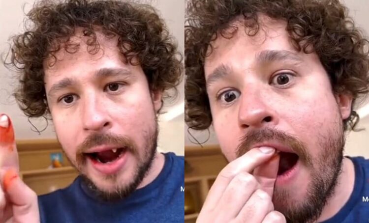 Luisito Comunica se le caen los dientes