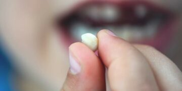 Que significa soñar que se te caen los dientes