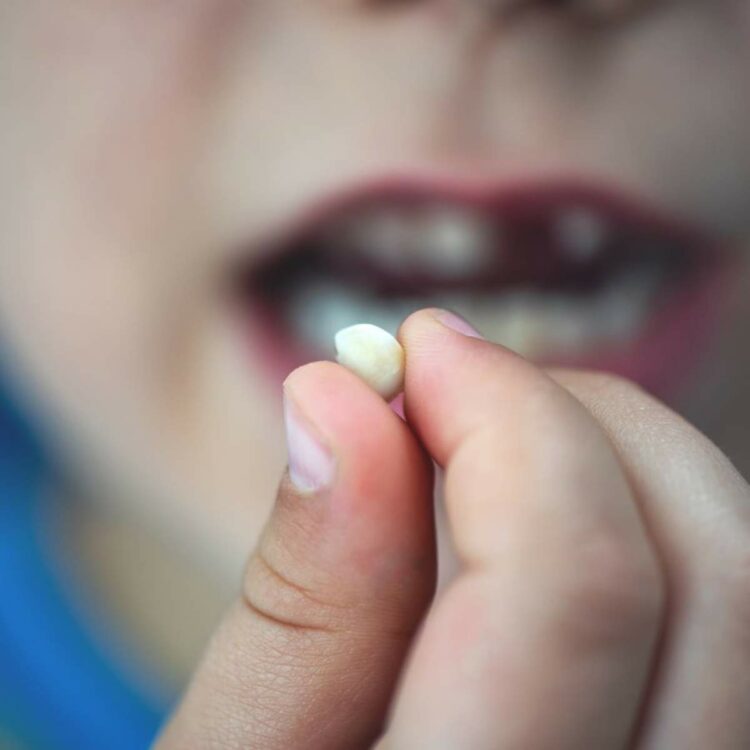 Que significa soñar que se te caen los dientes