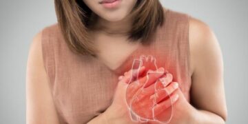 Imagen tomada de BBC.