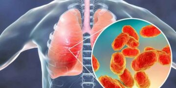 metapneumovirus-en-mexico-confirman-el-primer-caso-en-chihuahua