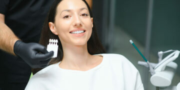 Carillas de resina: Tu sonrisa perfecta en una sola cita