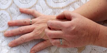 ¿Qué beneficios ofrece el karité para tratar problemas comunes como sequedad, eczema o inflamaciones cutáneas?