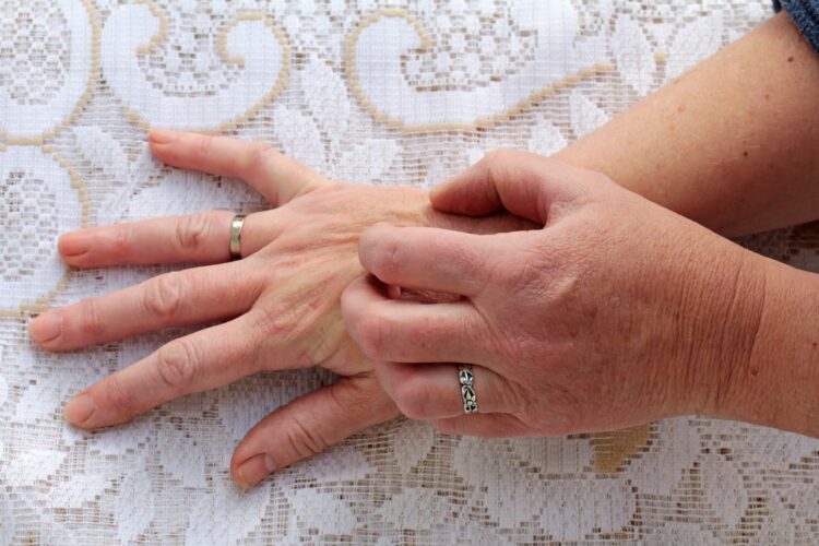 ¿Qué beneficios ofrece el karité para tratar problemas comunes como sequedad, eczema o inflamaciones cutáneas?