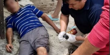 Perro muerde a peaton en la colonia 7 de Noviembre